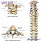 3B 척추차트 VR1152 Spinal Column 척추질병 병원액자_액자추가