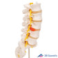 3B Scientific 인체모형 A76/5 후외측 배측방 디스크 요추