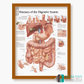3B Scientific 소화기질병 인체해부차트 VR1431 소화계질환 병원액자_액자없음