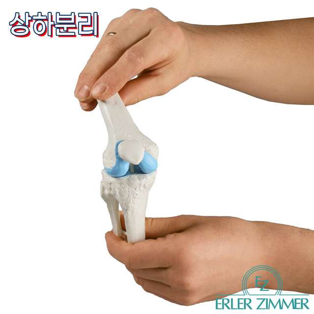 ERLER ZIMMER 인체모형 1125 무릎임플란트 3단계 무릎인공관절