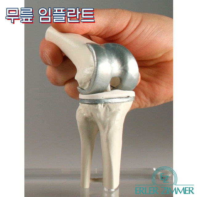 ERLER ZIMMER 인체모형 1125 무릎임플란트 3단계 무릎인공관절