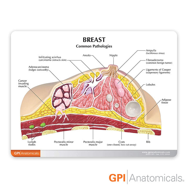 GPI USA 유방 해부모형 G345 유방단면모형 Female Breast