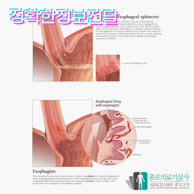 3B Scientific 두개골 인체해부차트 VR1131 The Human Skull 두개골구조 병원액자_액자없음