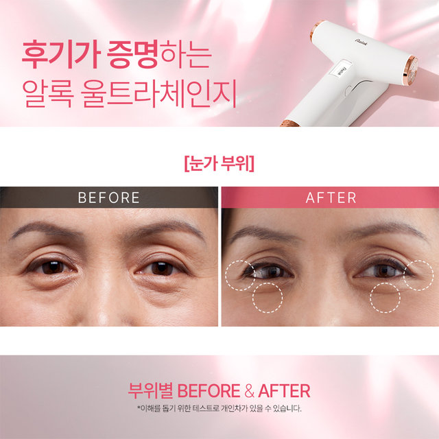 [신상품] 알록 울트라체인지 AUHR-3000