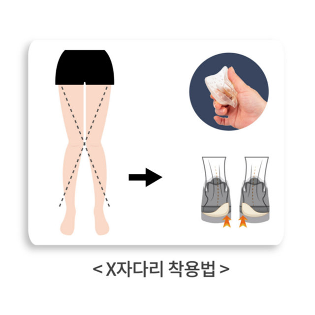 쿨핀 국내생산 오다리깔창 X자다리 오다리교정 탐나힐 뒤꿈치패드 2개 1세트